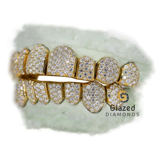 10 On 10 Diamond Grillz For Men