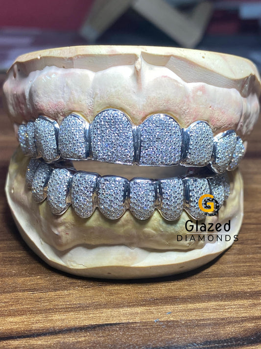 Custom Moisanite Grillz