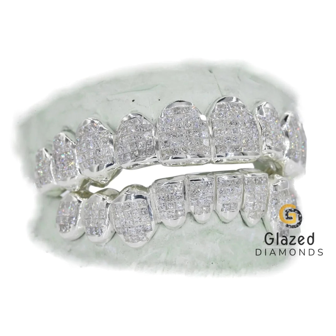 Customized Diamond Grillz