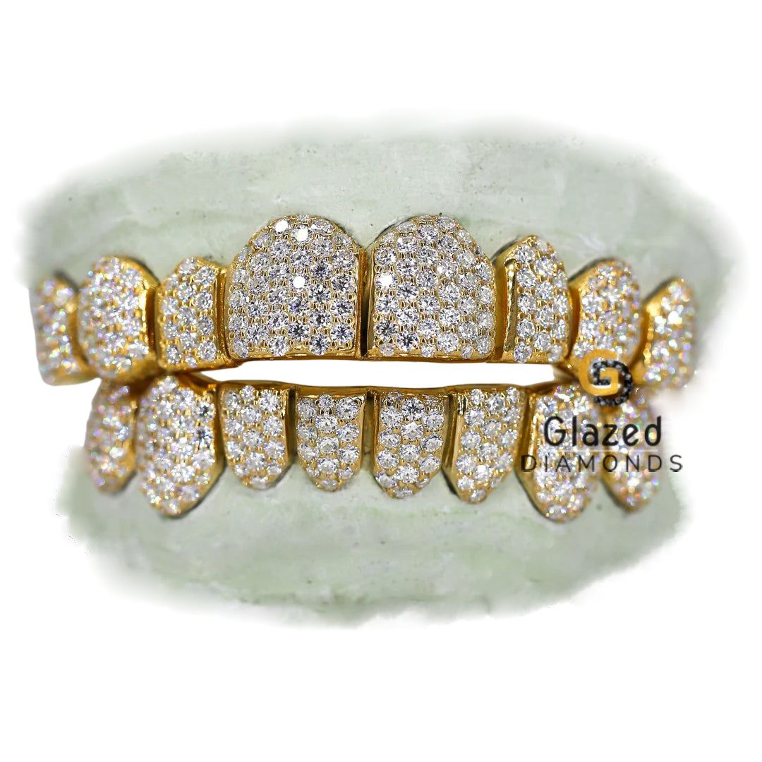 Custom Iced Out VVS Diamond Griilz – Glazed Diamonds