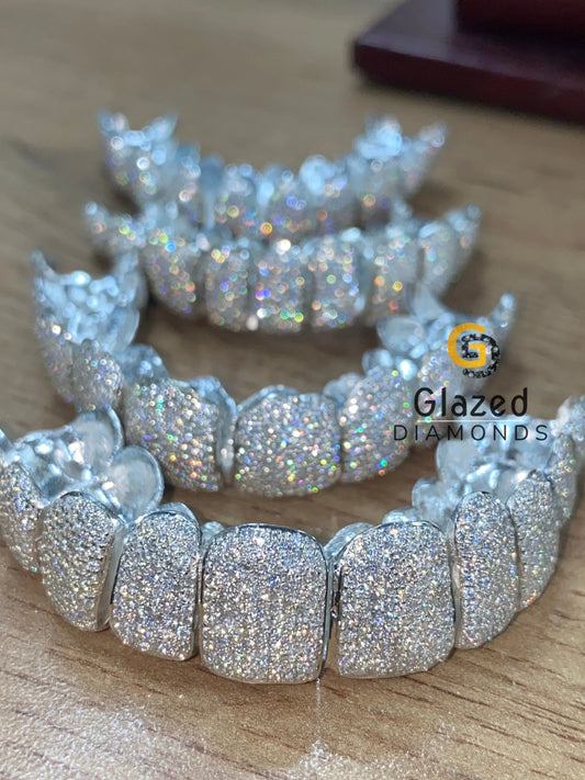 Full Iced Out Custom Perm Cut Moissanite Grillz