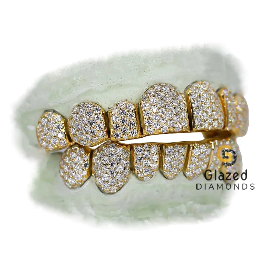 VVS Moissanite Diamond Grillz