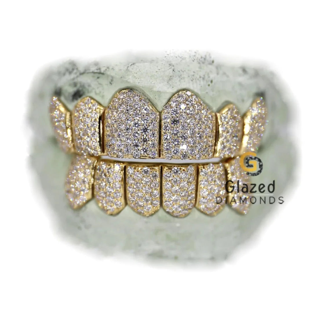 Teeth Bust Top Rated Store for Custom Moissanite Watch | Glazed Diamonds