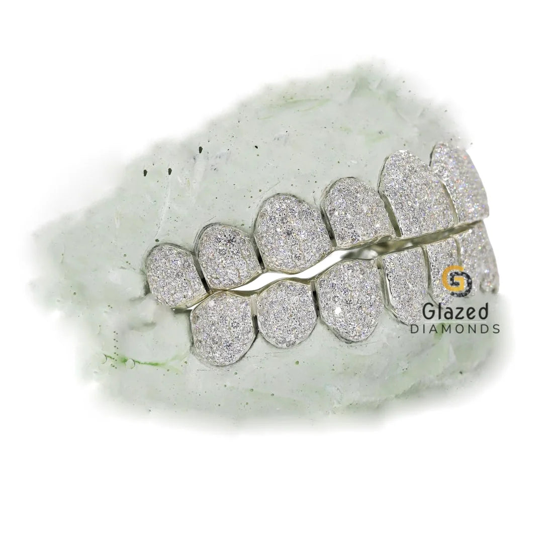 Fully Iced Out Moissanite Diamond Custom Grillz