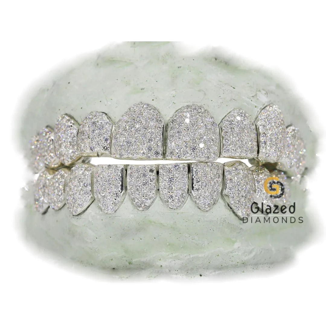 Fully Iced Out Moissanite Diamond Custom Grillz