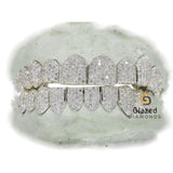 Fully Iced Out Moissanite Diamond Custom Grillz