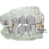 Customized Capped VVS Moissanite Iced Diamond Grillz