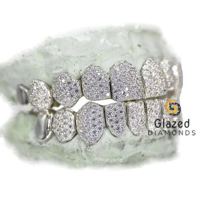 Diamond Studded Teeth