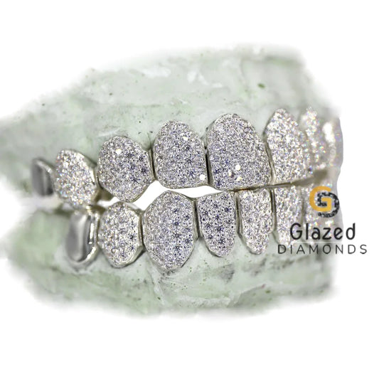 Diamond Studded Teeth
