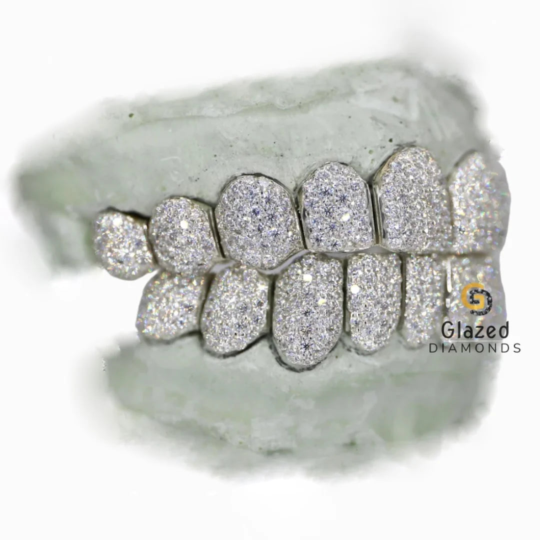 Custom Deep Cut Moissanite Diamond Grillz