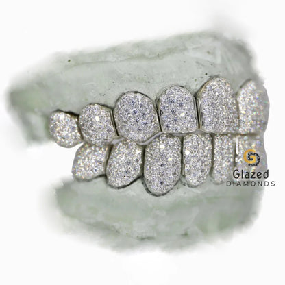 Iced Out Teeth