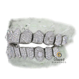 Custom Iced Out Moissanite Round Big Diamond Grillz