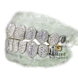 Customized Capped VVS Moissanite Iced Diamond Grillz