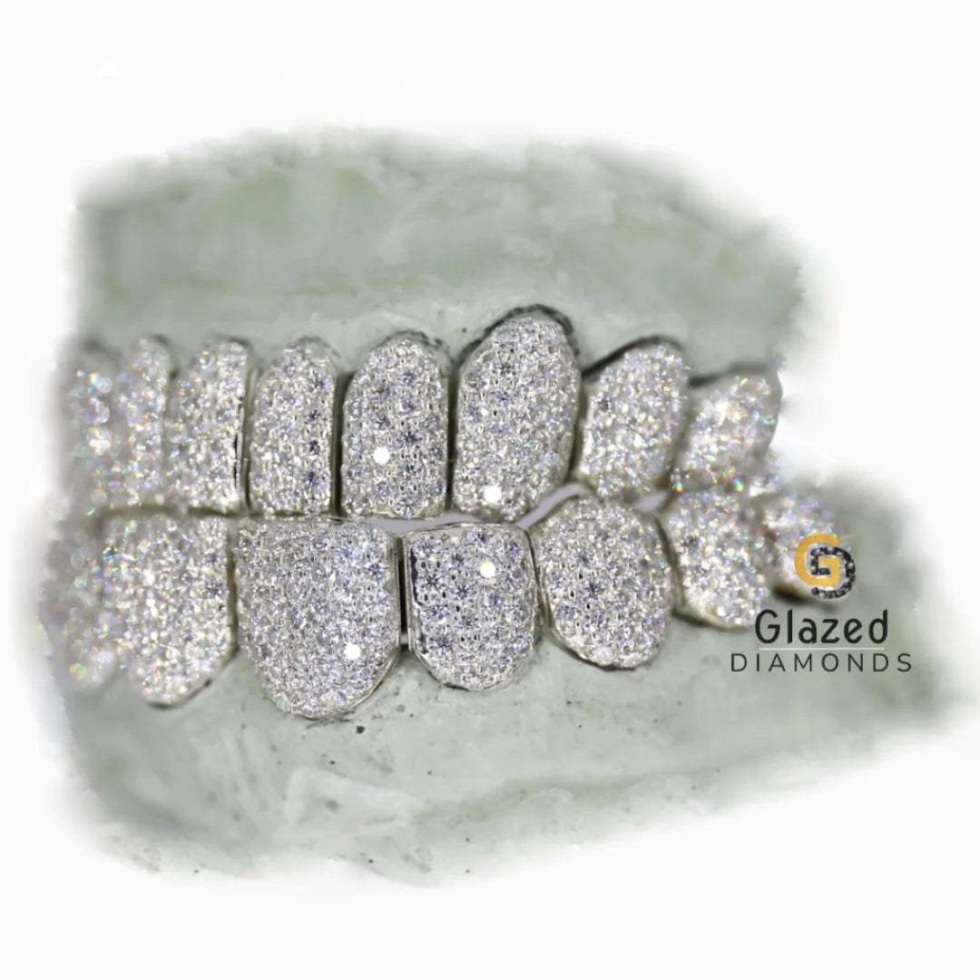 Moissanite Diamond Grillz