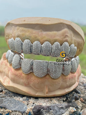 Moissanite Grillz Fo r Men