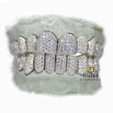 Custom Deep Cut Moissanite Diamond Grillz