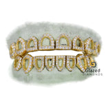 Custom VVS Moissanite Iced Out Open Face Diamond Grillz