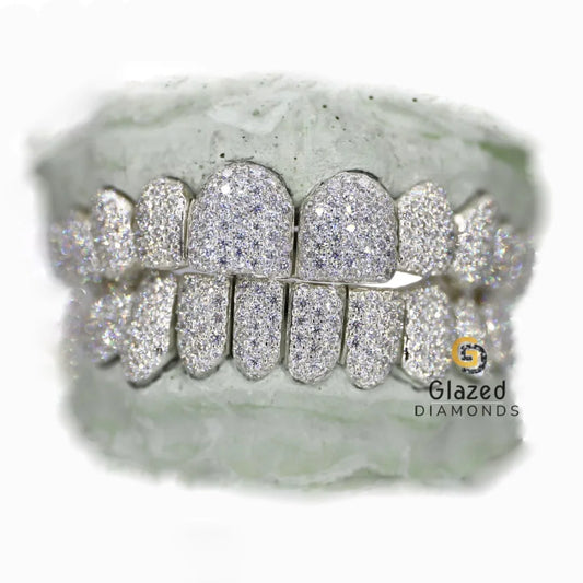 VVS Diamond Grillz