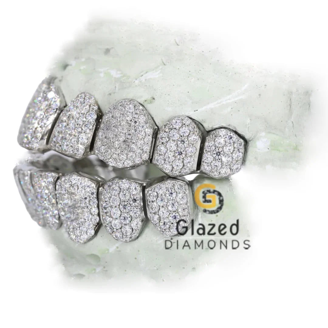 VVS Moissanite Grillz