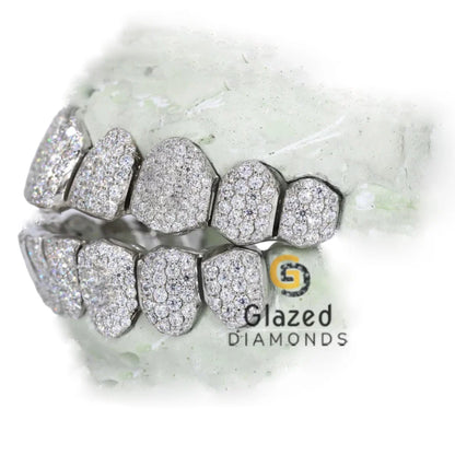 VVS Moissanite Grillz